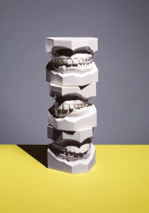 The New Perfect Smile Isn't That Perfect 1 teeth molds totem gray yellow background VSS1 1